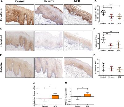 Celiac Disease Causes Epithelial Disruption and Regulatory T Cell Recruitment in the Oral Mucosa